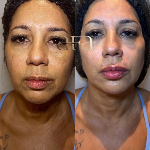 WhatsApp Image 2026-02-23 at 16.44.51