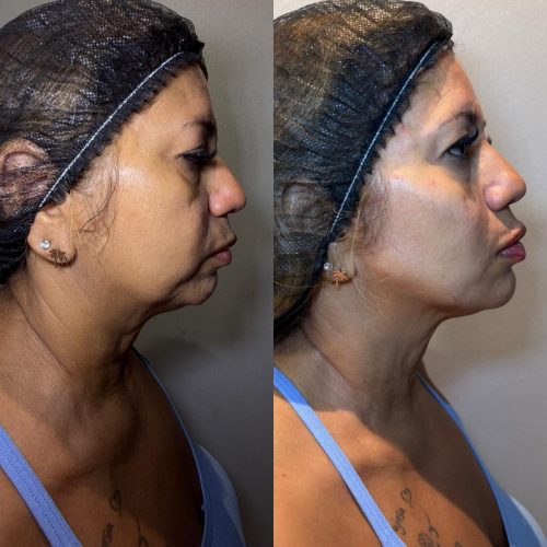 WhatsApp Image 2026-02-23 at 16.44.52